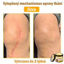 Doporučeno nemocnicí Semmelweis · Oficiální obchod BENU✨✨ APKAPK® krém na regeneraci kůže s včelím jedem