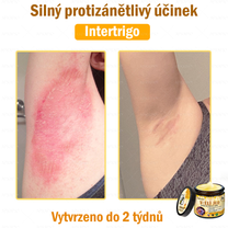 Doporučeno nemocnicí Semmelweis · Oficiální obchod BENU✨✨ APKAPK® krém na regeneraci kůže s včelím jedem