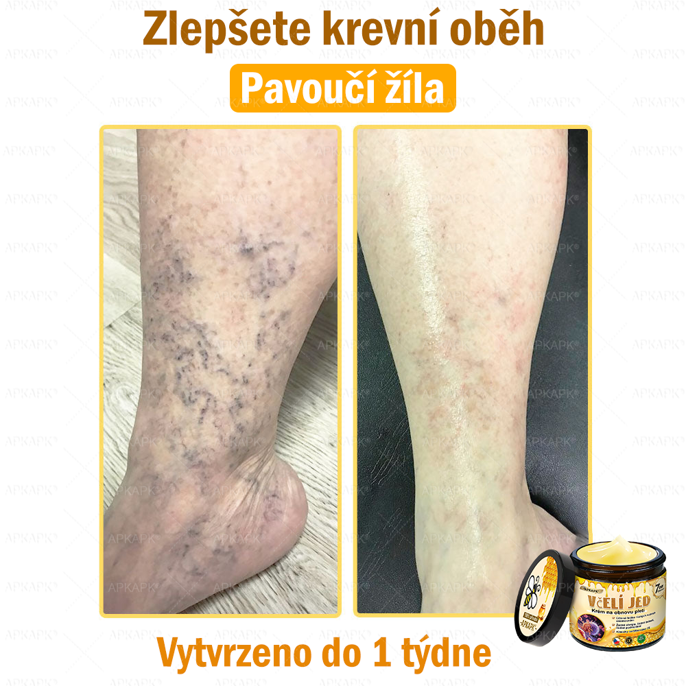 😋😋Dermatologicky a klinicky testováno👩‍⚕️APKAPK®Bee Venom Krém na obnovení pleti🐝 pomáhá při léčbě kožních problémů, jako jsou: vrásky, jizvy, pigmentové skvrny, strie, akné, psoriáza, ekzém, kožní změny, podráždění, záněty a další kožní problémy.