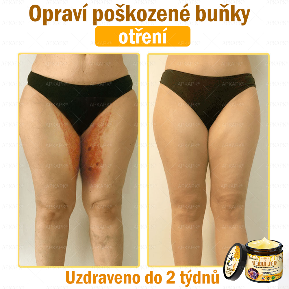 😋😋Dermatologicky a klinicky testováno👩‍⚕️APKAPK®Bee Venom Krém na obnovení pleti🐝 pomáhá při léčbě kožních problémů, jako jsou: vrásky, jizvy, pigmentové skvrny, strie, akné, psoriáza, ekzém, kožní změny, podráždění, záněty a další kožní problémy.