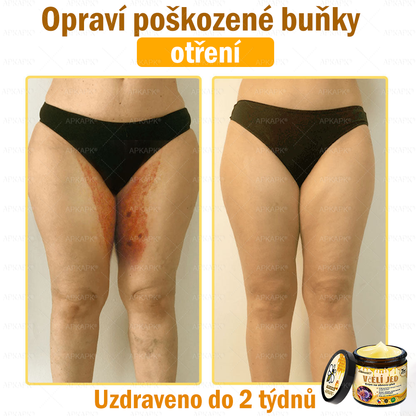😋😋Dermatologicky a klinicky testováno👩‍⚕️APKAPK®Bee Venom Krém na obnovení pleti🐝 pomáhá při léčbě kožních problémů, jako jsou: vrásky, jizvy, pigmentové skvrny, strie, akné, psoriáza, ekzém, kožní změny, podráždění, záněty a další kožní problémy.