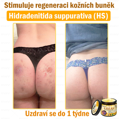 😋😋Dermatologicky a klinicky testováno👩‍⚕️APKAPK®Bee Venom Krém na obnovení pleti🐝 pomáhá při léčbě kožních problémů, jako jsou: vrásky, jizvy, pigmentové skvrny, strie, akné, psoriáza, ekzém, kožní změny, podráždění, záněty a další kožní problémy.