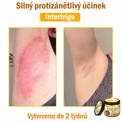 😋😋Dermatologicky a klinicky testováno👩‍⚕️APKAPK®Bee Venom Krém na obnovení pleti🐝 pomáhá při léčbě kožních problémů, jako jsou: vrásky, jizvy, pigmentové skvrny, strie, akné, psoriáza, ekzém, kožní změny, podráždění, záněty a další kožní problémy.