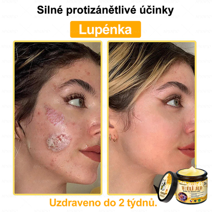 😋😋Dermatologicky a klinicky testováno👩‍⚕️APKAPK®Bee Venom Krém na obnovení pleti🐝 pomáhá při léčbě kožních problémů, jako jsou: vrásky, jizvy, pigmentové skvrny, strie, akné, psoriáza, ekzém, kožní změny, podráždění, záněty a další kožní problémy.