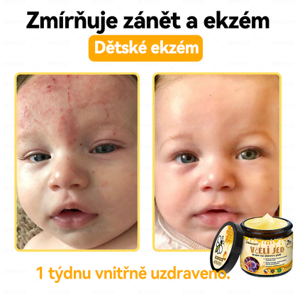 😋😋Dermatologicky a klinicky testováno👩‍⚕️APKAPK®Bee Venom Krém na obnovení pleti🐝 pomáhá při léčbě kožních problémů, jako jsou: vrásky, jizvy, pigmentové skvrny, strie, akné, psoriáza, ekzém, kožní změny, podráždění, záněty a další kožní problémy.