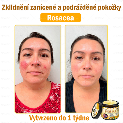 😋😋Dermatologicky a klinicky testováno👩‍⚕️APKAPK®Bee Venom Krém na obnovení pleti🐝 pomáhá při léčbě kožních problémů, jako jsou: vrásky, jizvy, pigmentové skvrny, strie, akné, psoriáza, ekzém, kožní změny, podráždění, záněty a další kožní problémy.