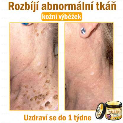 😋😋Dermatologicky a klinicky testováno👩‍⚕️APKAPK®Bee Venom Krém na obnovení pleti🐝 pomáhá při léčbě kožních problémů, jako jsou: vrásky, jizvy, pigmentové skvrny, strie, akné, psoriáza, ekzém, kožní změny, podráždění, záněty a další kožní problémy.