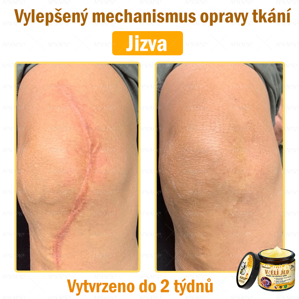😋😋Dermatologicky a klinicky testováno👩‍⚕️APKAPK®Bee Venom Krém na obnovení pleti🐝 pomáhá při léčbě kožních problémů, jako jsou: vrásky, jizvy, pigmentové skvrny, strie, akné, psoriáza, ekzém, kožní změny, podráždění, záněty a další kožní problémy.