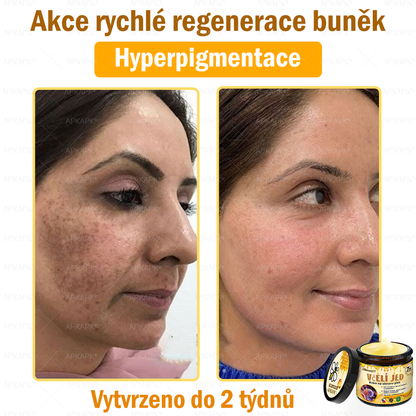 😋😋Dermatologicky a klinicky testováno👩‍⚕️APKAPK®Bee Venom Krém na obnovení pleti🐝 pomáhá při léčbě kožních problémů, jako jsou: vrásky, jizvy, pigmentové skvrny, strie, akné, psoriáza, ekzém, kožní změny, podráždění, záněty a další kožní problémy.