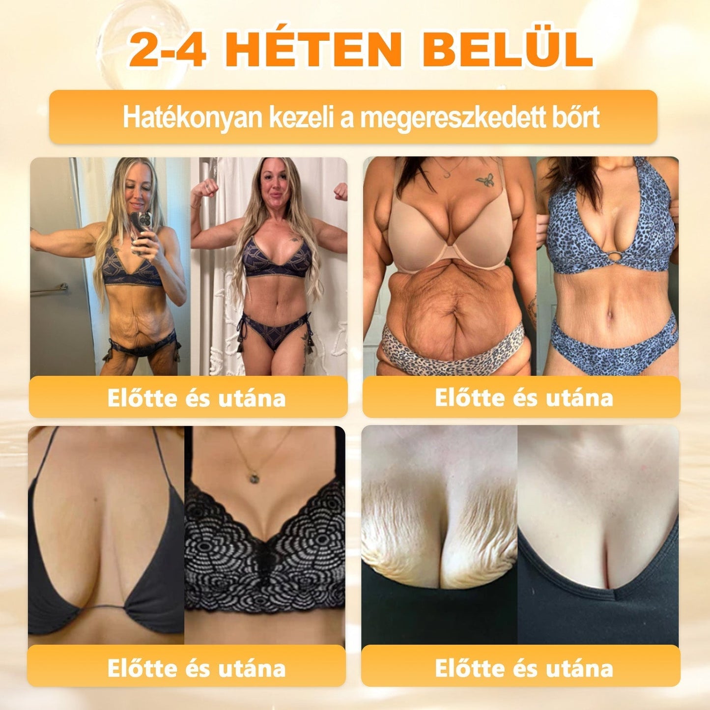 Doporučeno nemocnicí Semmelweis · Oficiální obchod BENU✨✨ APKAPK® krém na regeneraci kůže s včelím jedem